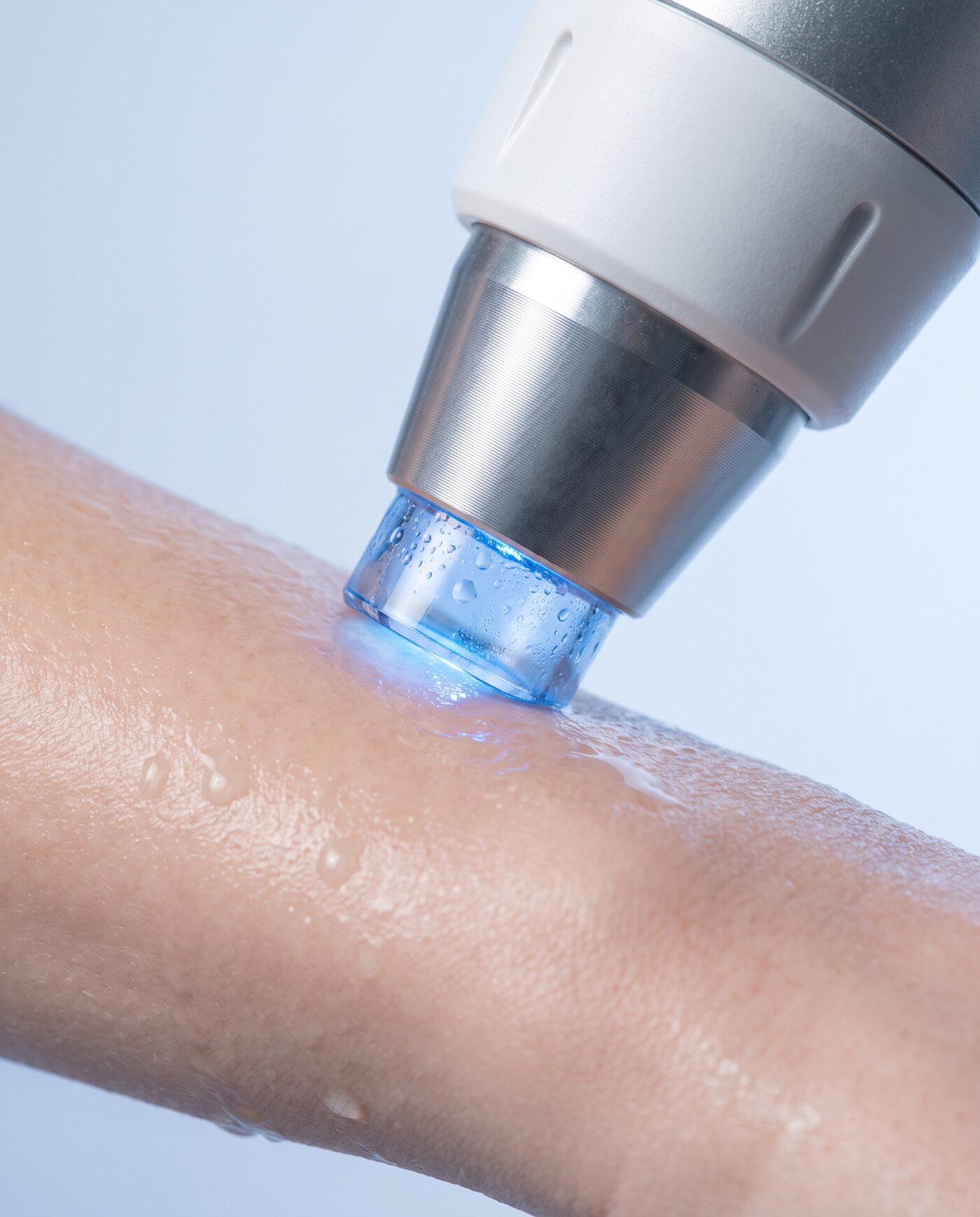 Detailansicht des Diodenlaser-Handstücks auf seidig glatter Haut